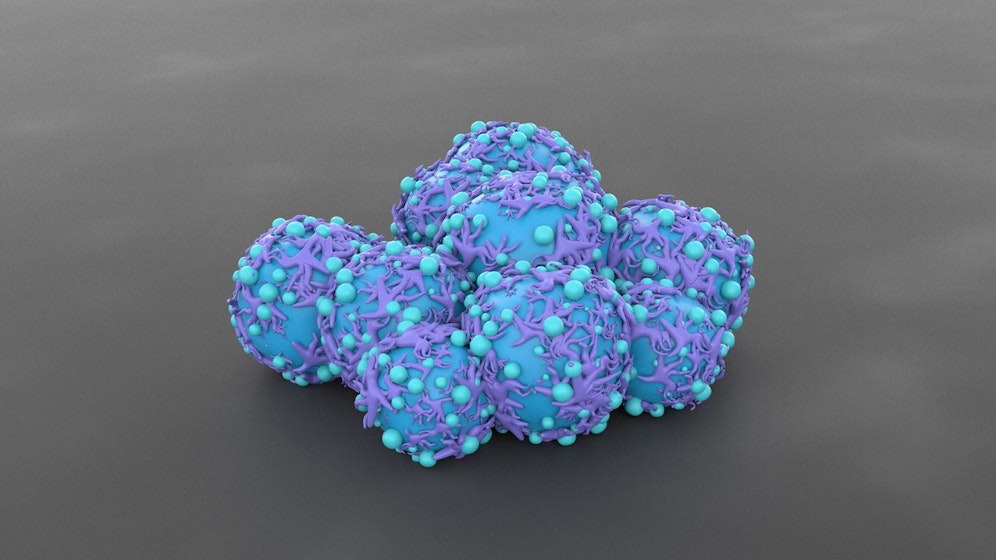 Gebärmutterhalskrebs ist einer der 4 häufigsten Krebsarten bei Frauen. Deshalb ist die jährliche Vorsorgeuntersuchung beim Gynäkologen so wichtig.