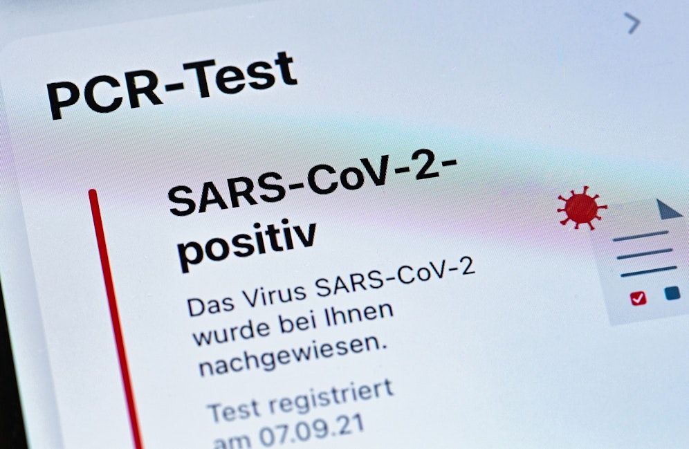 Erstmals konnte der gesamte Krankheitsverlauf einer Corona-Infektion dokumentiert werden.