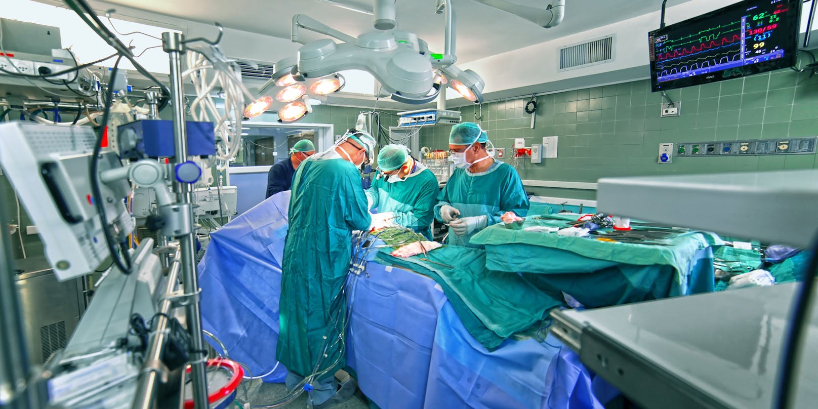 Ärzte im Operationssaal (Symbolfoto).