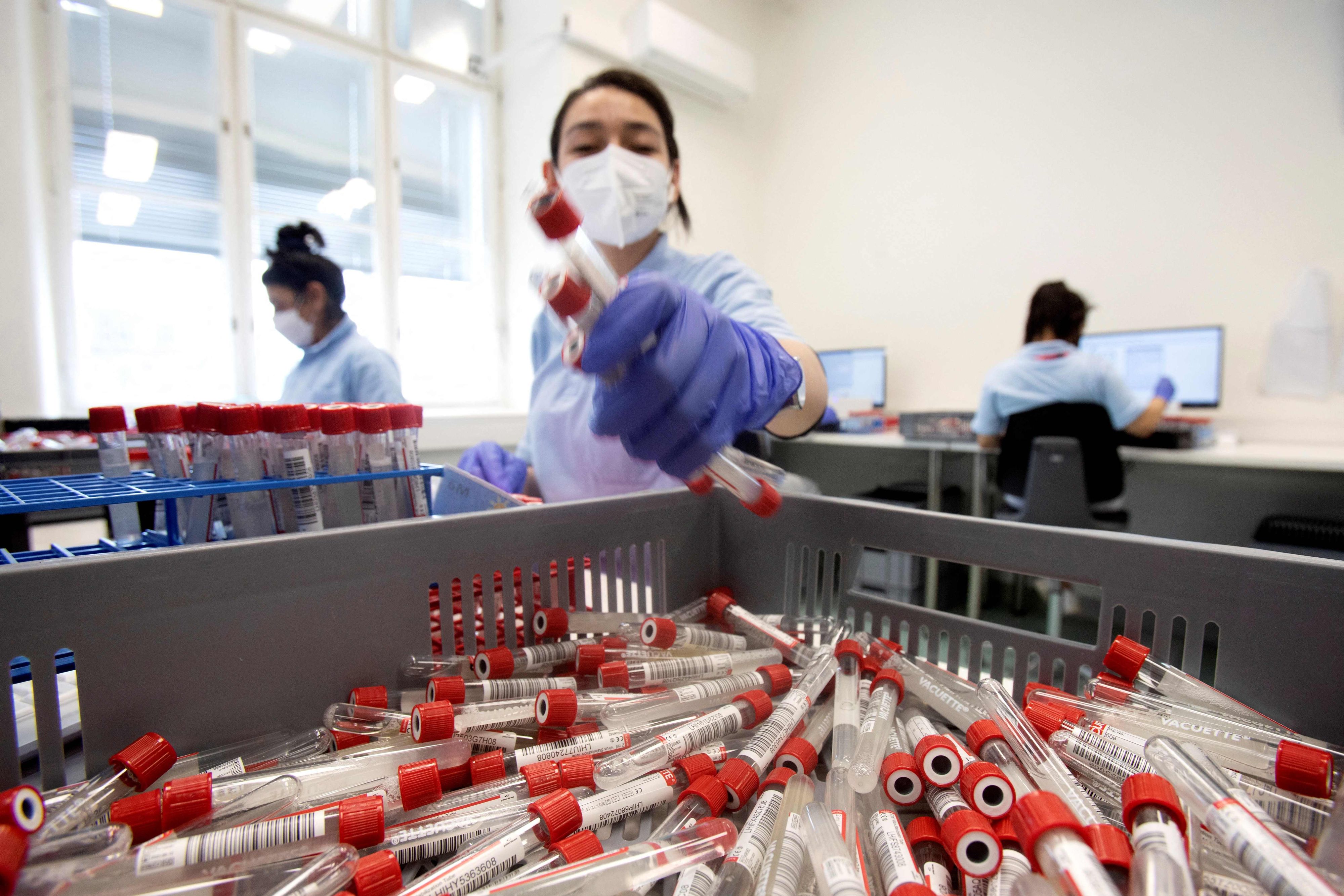 Das Labor von Lifebrain wertet die "Alles gurgelt"-Tests in Wien aus.