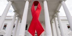 Erste Frau wird in den USA von HIV geheilt