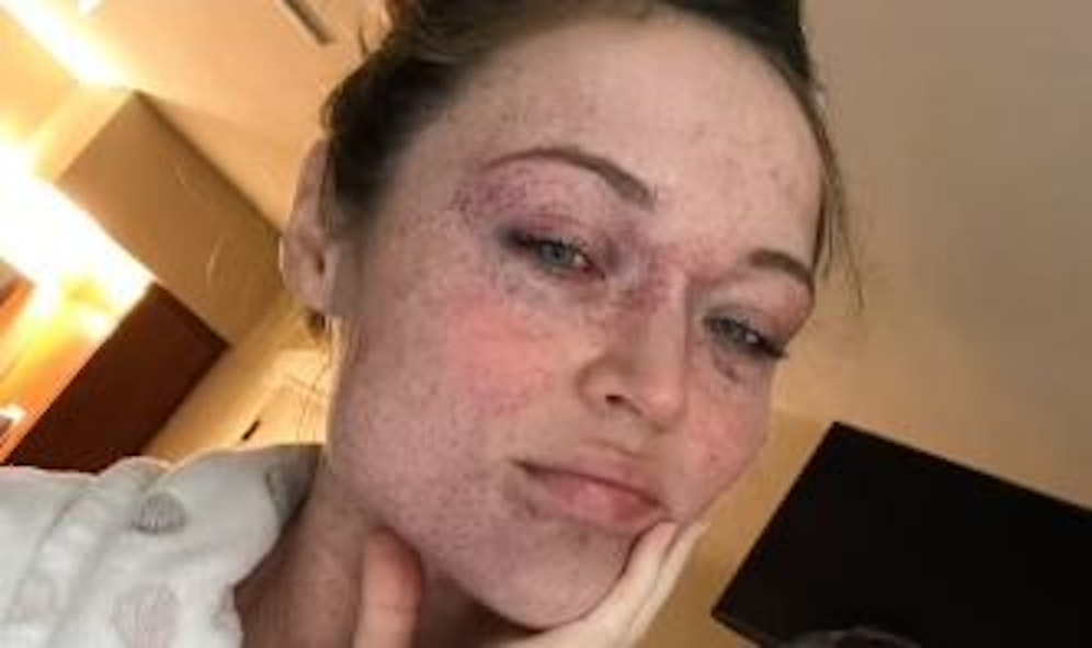 Die Geburt ihres Sohnes stand Mama Yelena zwei Wochen so ins Gesicht geschrieben.