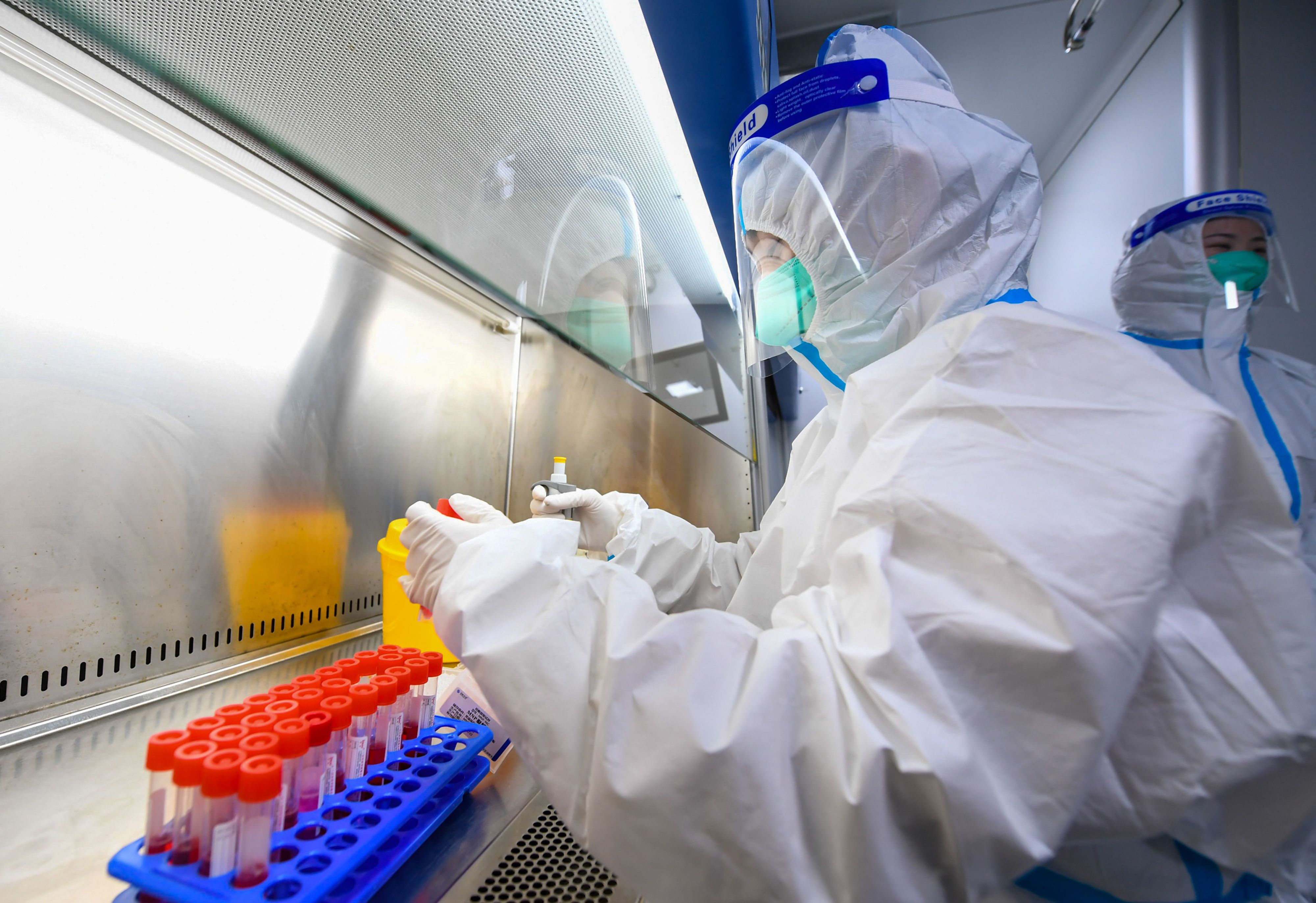 Die Forscher kommen zu einem unerwarteten Ergebnis bei der Corona-Studie.