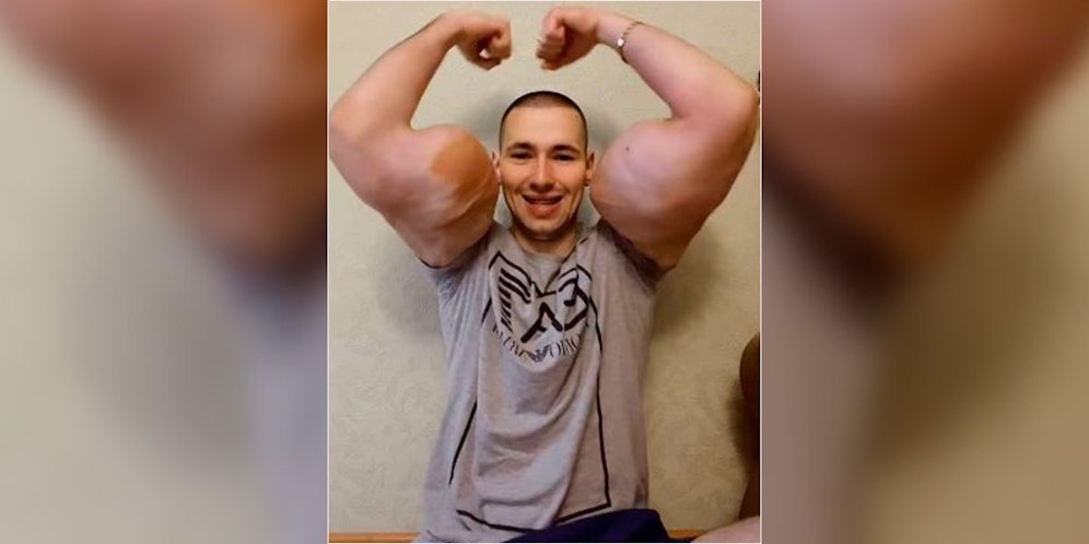 Solche Arme sind in den allerseltensten Fällen das Ergebnis ehrlichen Trainings.