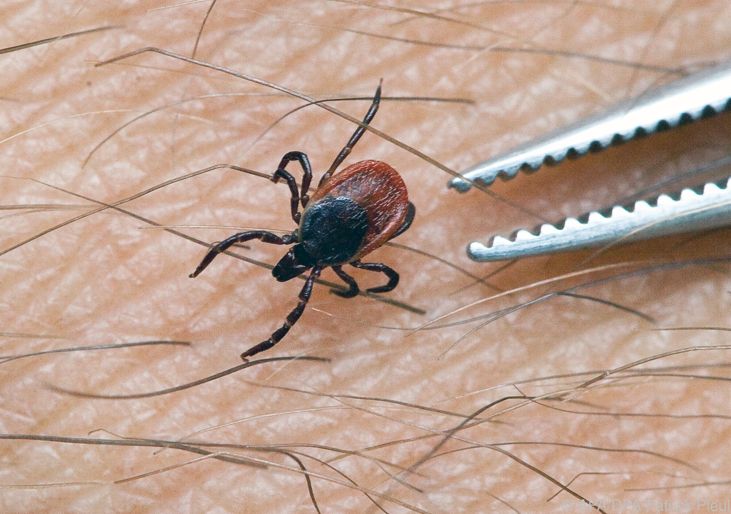 Eine Zecke krabbelt auf einem Arm (Archivbild 22.06.2009). Zwischen März und Oktober werden jährlich tausende Österreicher von diesem Spinnentier gestochen, das den Erreger der Gehirn- bzw. Gehirnhautentzündung (FSME) überträgt. APA-FOTO: DPA/Patrick Pleul