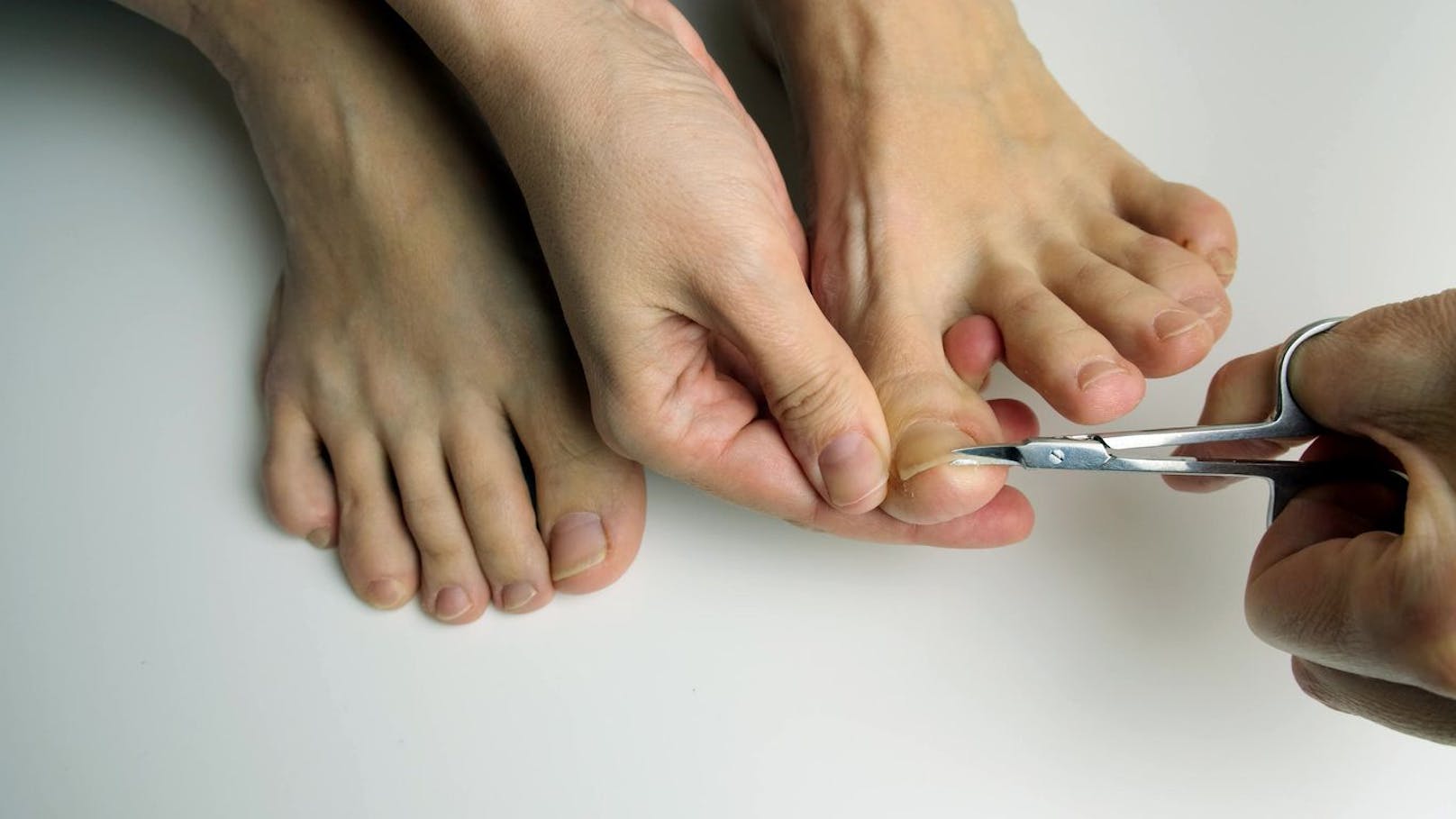 <strong>Die richtige Länge:</strong>&nbsp;Die richtige Nagellänge ist nicht nur für die Optik, sondern auch für die Gesundheit deiner Nägel wichtig. Wenn du deine Fußnägel zu kurz schneidest, können sie deine Zehen nicht mehr richtig schützen. Du merkst das zum Beispiel, wenn deine Schuhe einen unangenehmen Druck auf deine Nägel ausüben. Auch Entzündungen und Schäden am Nagelbett können durch zu kurz geschnittene Nägel entstehen.&nbsp;Die Zehenkuppe sollte nach dem Kürzen gerade noch vom Nagel bedeckt sein. Der verbleibende freie Nagelrand sollte etwa <strong>1-2 Millimeter</strong> lang sein.