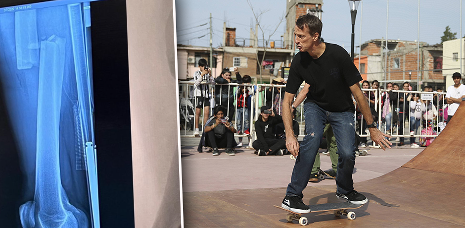 Tony Hawk