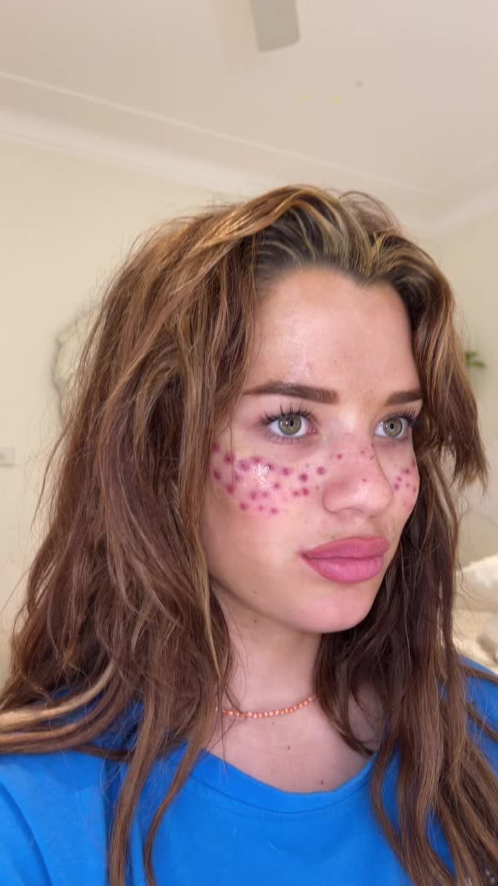 Die australische Influencerin Tilly Whitfeld hat ihren eigenen Rat über Bord geworfen und lässt erneut Tinte in ihr Gesicht.