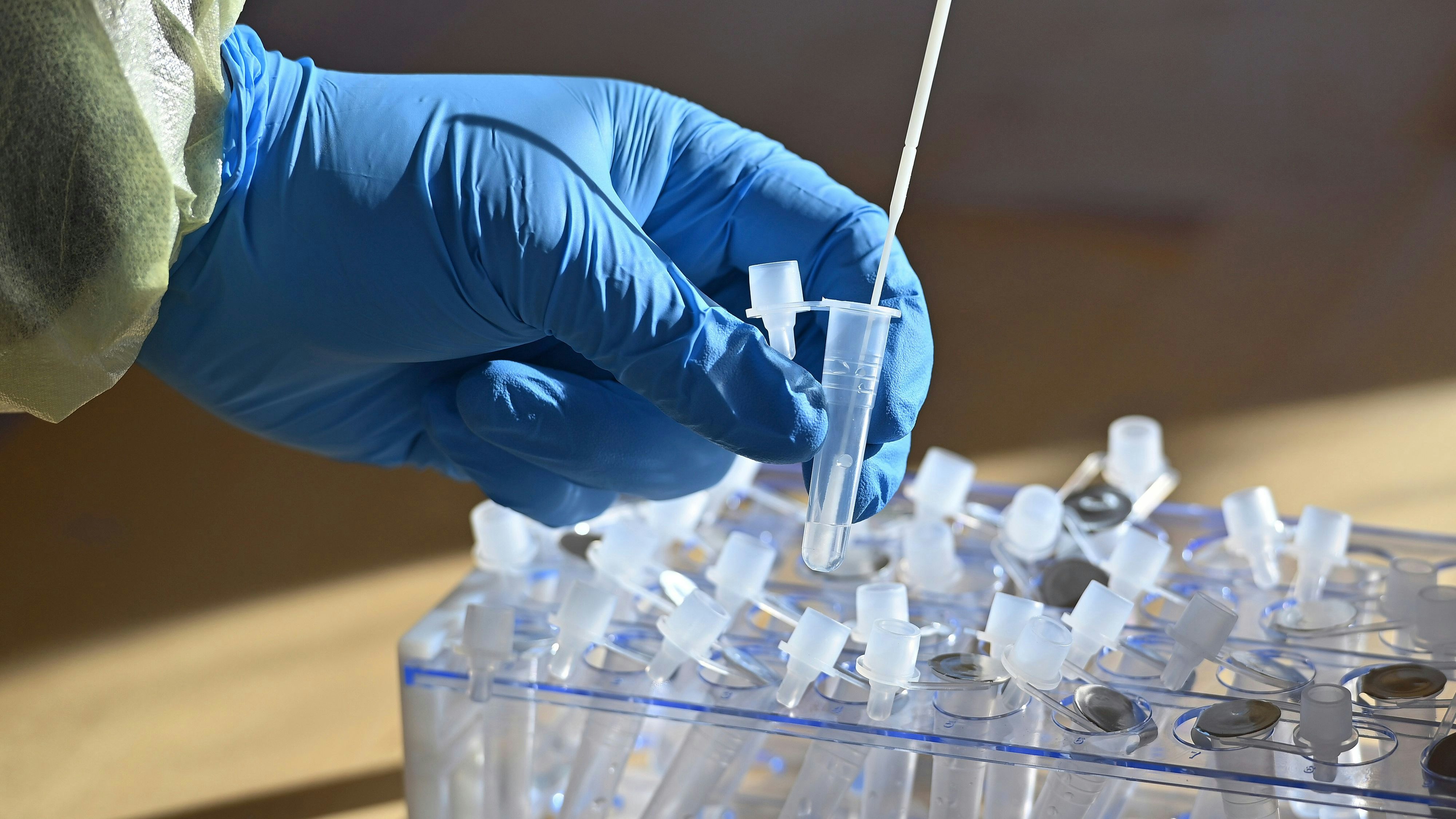 Die Zahl der positiven Corona-Tests steigt vielerorts weiter an. 