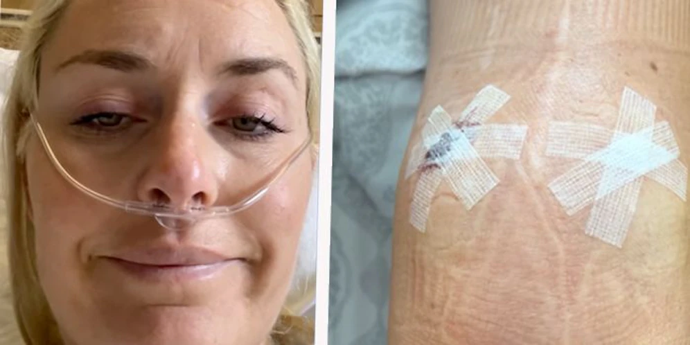 Lindsey Vonn zeigt Bilder nach ihrer Knie-Operation.