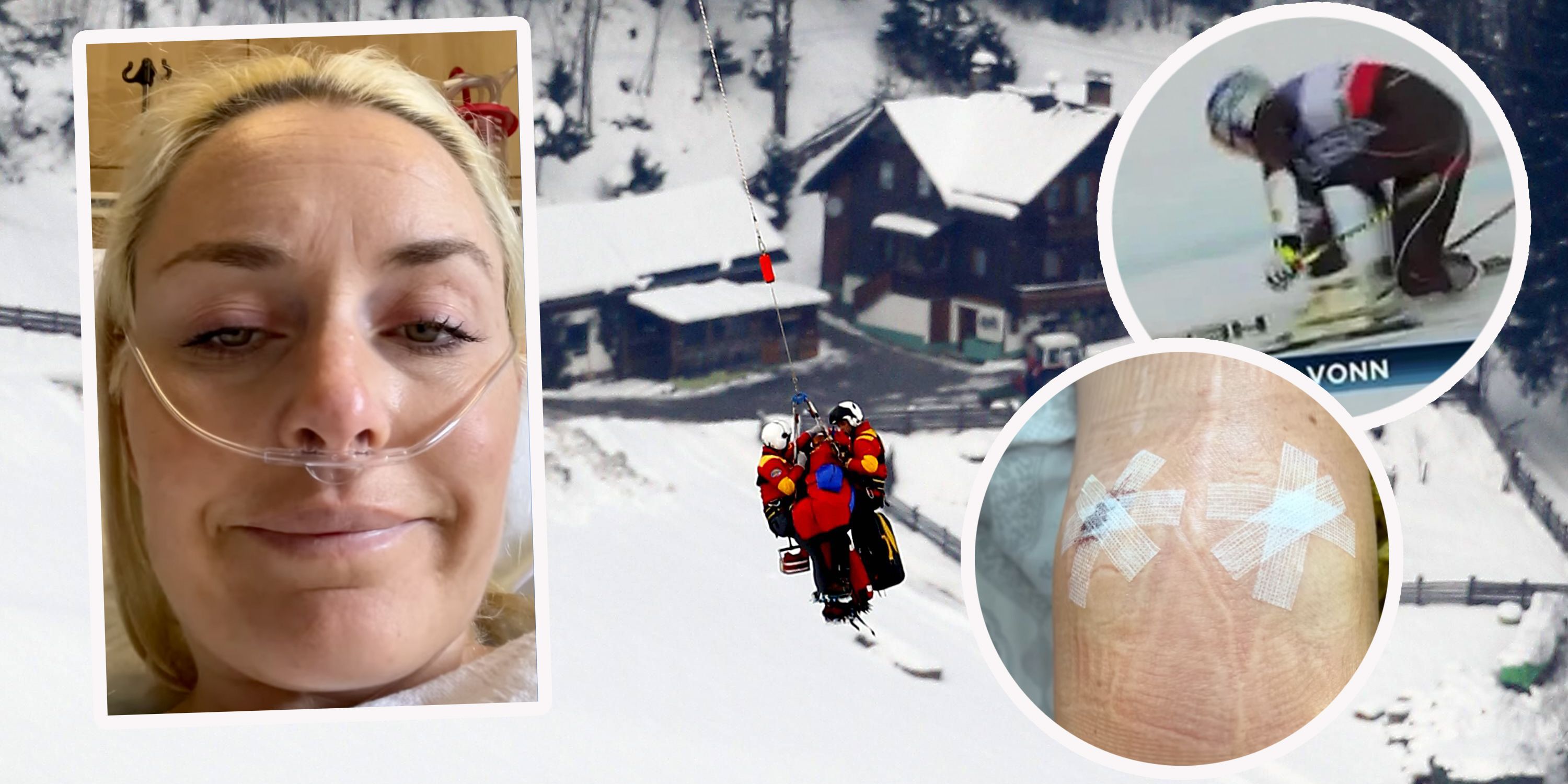 Lindsey Vonn erlitt in ihrer Karriere schwere Stürze. Auch in der Ski-Pension benötigt sie noch operationen.