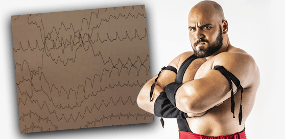 Wrestling-Star Sultanov zeigt "Heute" sein extremes EKG