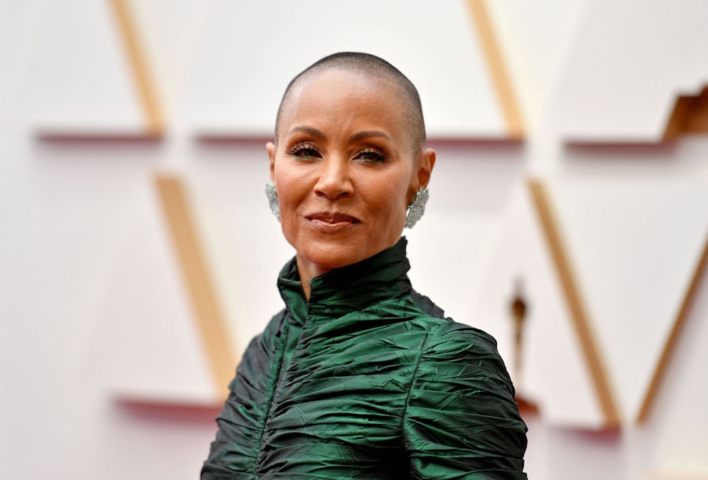 Schauspielerin Jada Pinkett-Smith trägt nicht freiwillig kurze Haare – sondern leidet an einer Krankheit.