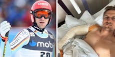 Schwerer Sturz, OP – Ski-Star landet im Krankenhaus
