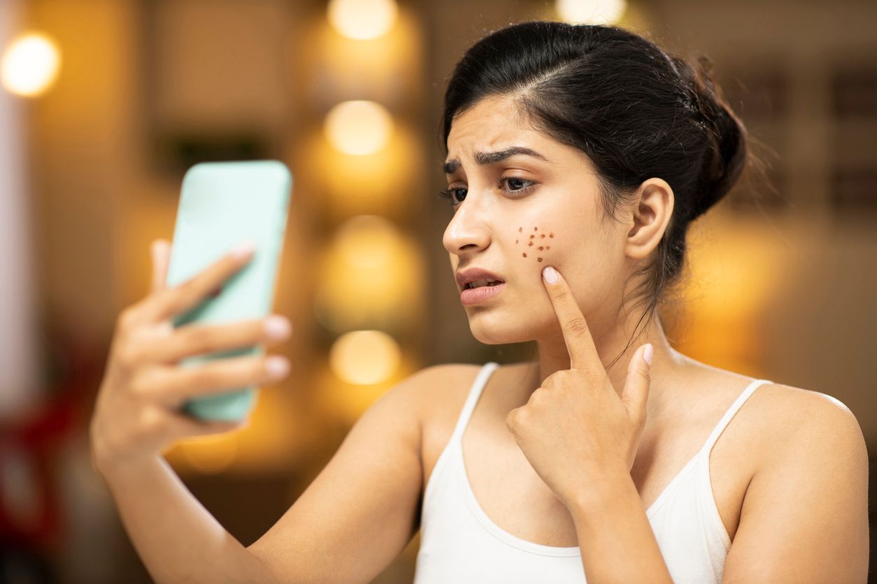 Für deinen nächsten Arzttermin musst du nicht einmal dein Zuhause verlassen. Mit Hilfe von Online-Dermatologen kannst du deine Hautprobleme schnell, einfach und digital lösen. Aber ist die  Innovation auch effektiv?