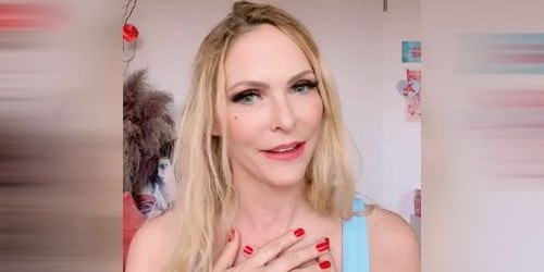 Nach ihrer Krebs-Therapie sind ihr Haare ausgefallen.