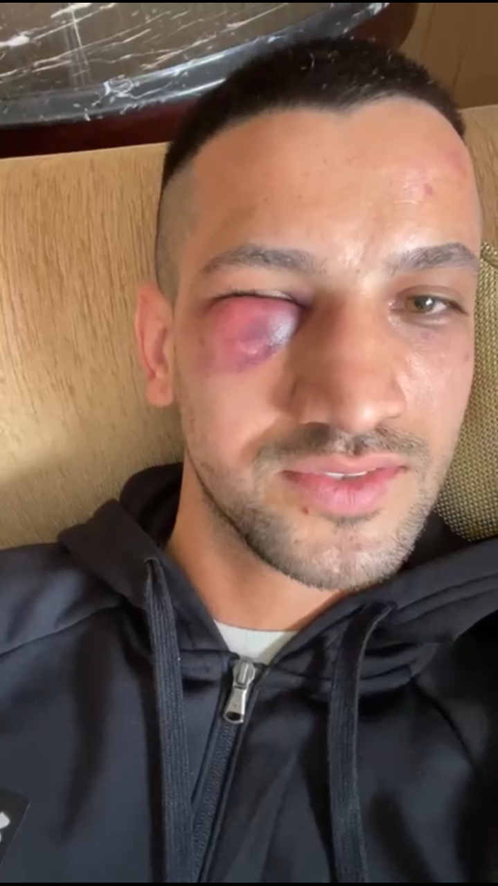 Boxer Marcos Nader am Tag nach dem K.o.