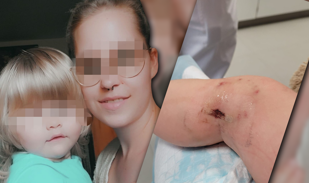 Die Niederösterreicherin (25) rettete ihre Zwillingstöchter vor einem Hunde-Angriff.