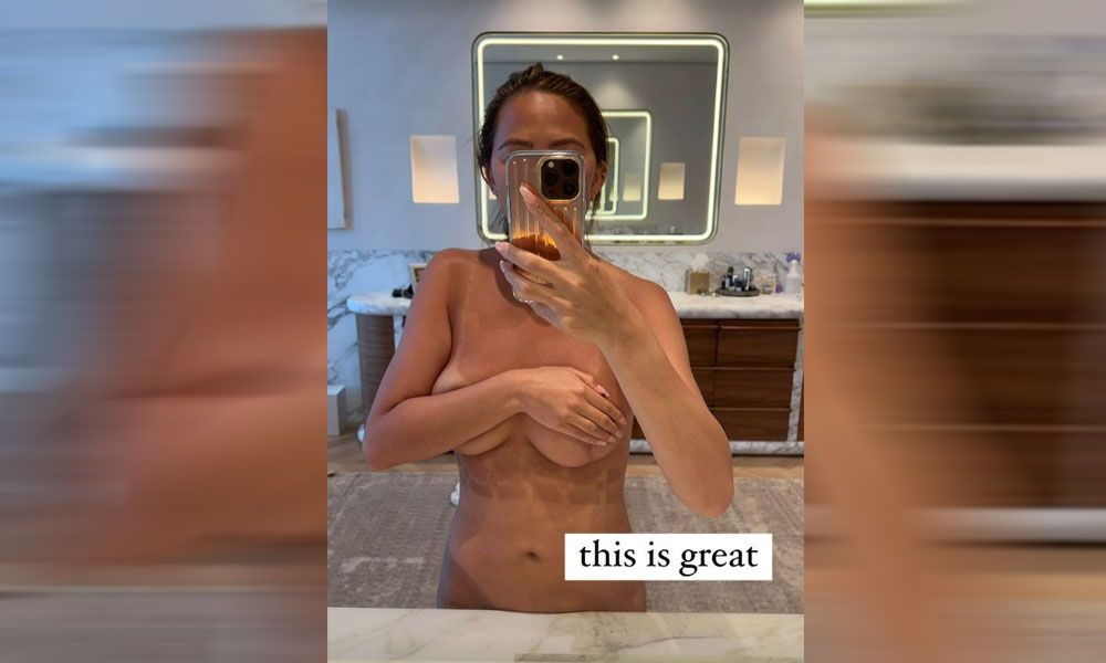 Die zweifache Mutter zeigt ihre lustigen Bikiniabdrücke.