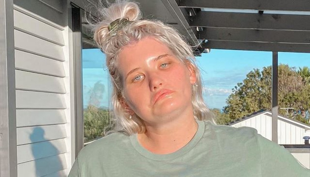 Erfolgreich mit Individualität: Einen Vertrag mit einer internationalen Modelagentur hat Tayla schon in der Tasche.