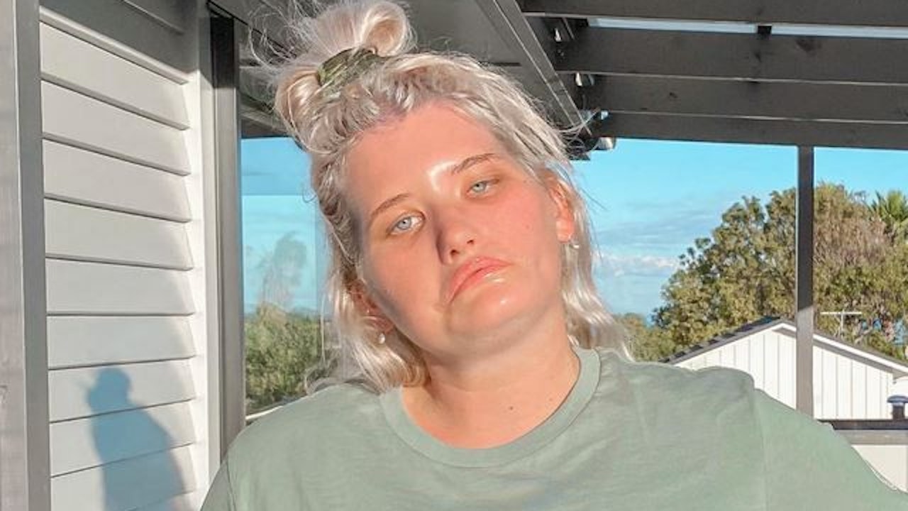 Heute.at - Sie wollte sterben – jetzt ist Frau ohne Lachen Model