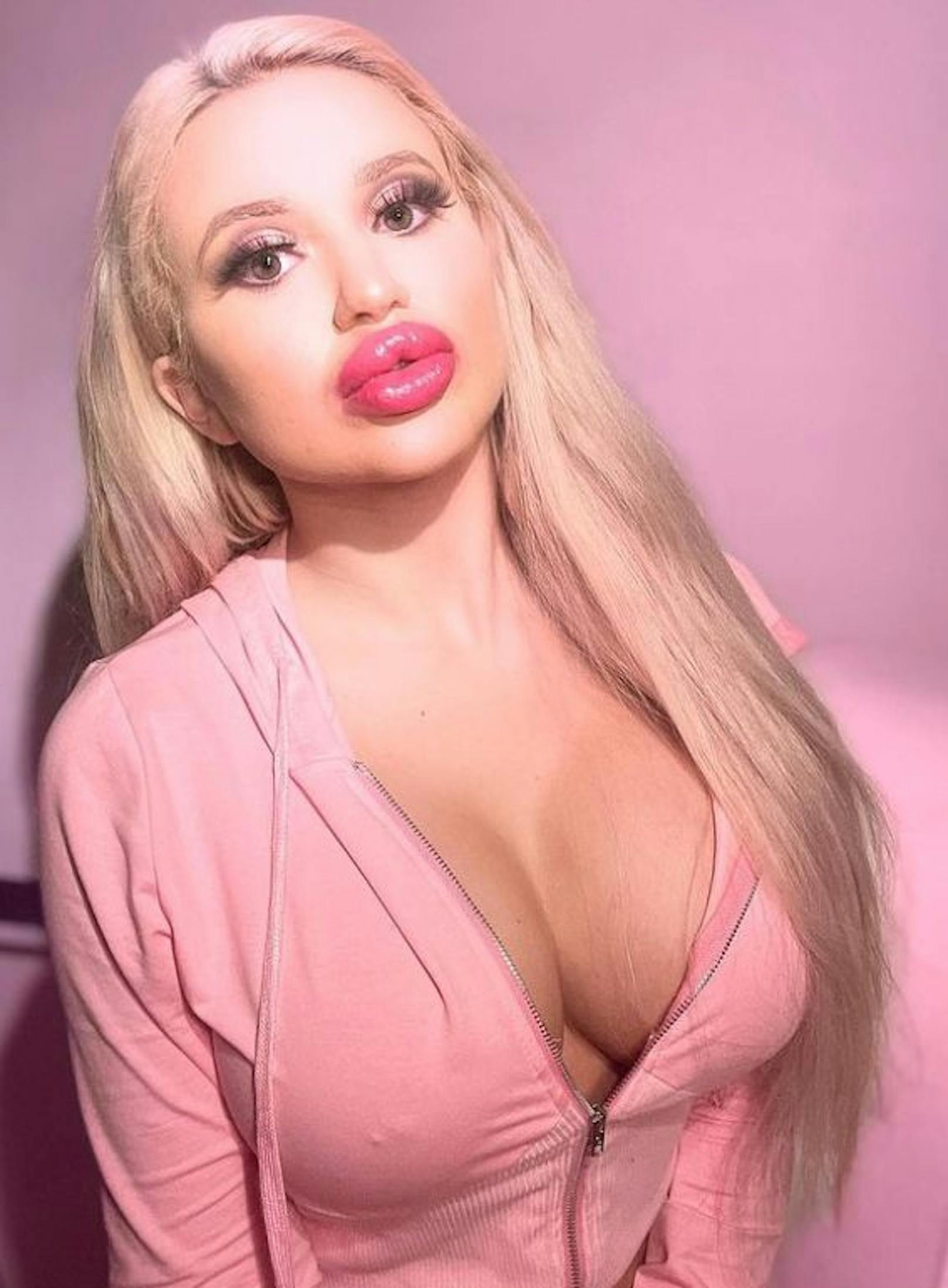 Wienerin Jessy hat mehr als 50.000 Euro für Beauty-Operationen ausgegeben. Doch die 21-Jährige hat nach drei Brust-Op's und einem Po-Eingriff sowie mehreren Lippenaufspritzungen noch nicht genug.