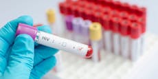 Mehr undiagnostizierte HIV-Fälle bei Hetero-Männern