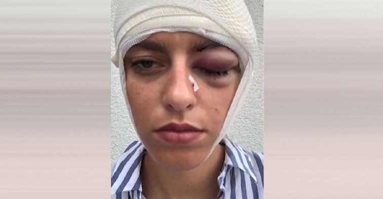 Schock für Vanessa Hampl