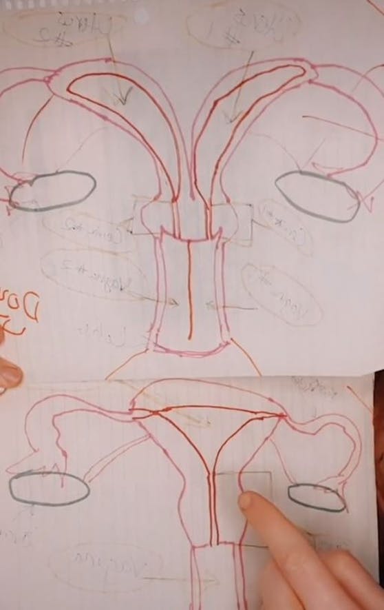 Leannes Skizze: Oben sehen wir ihre Anatomie mit 2 Vaginen und 2 Gebärmüttern, unten die normale Bauweise.