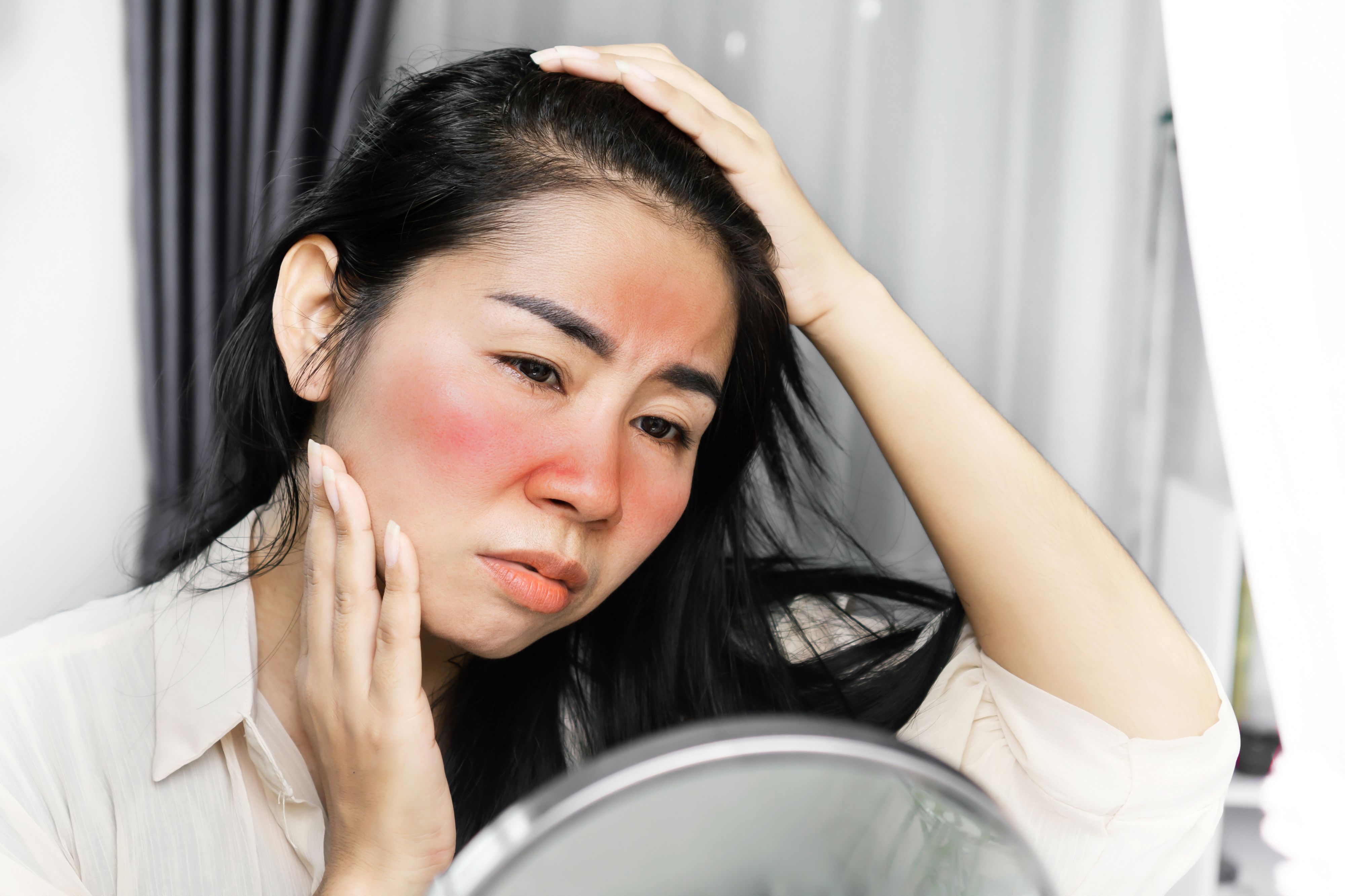 sad Asian woman having problem with sunburn on the face, checking her redness skin on a mirror because of ultraviolet from sunlight