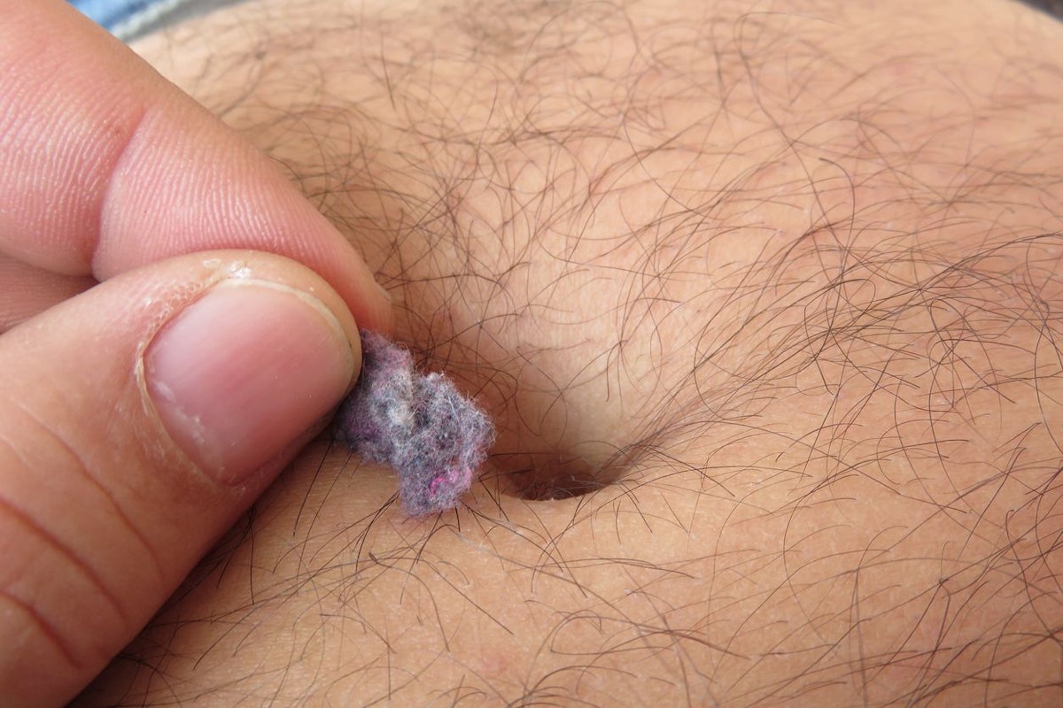 Ein nach innen gewölbter Bauchnabel ist eine wahre Brutstätte für Bakterien und andere kleine Lebewesen. Außerdem sammeln sich noch Fusseln von deiner Kleidung und andere Partikel dort an. Daher solltest du immer darauf achten, dass dein Nabel schön sauber und gereinigt ist. 