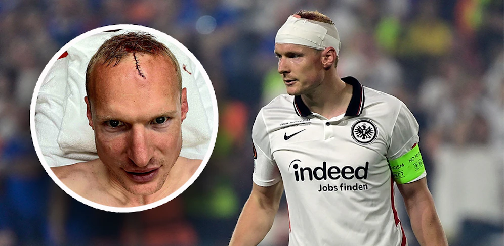 Sebastian Rode erlitt im Europa-League-Finale eine Kopfwunde, postete ein Bild davon. 