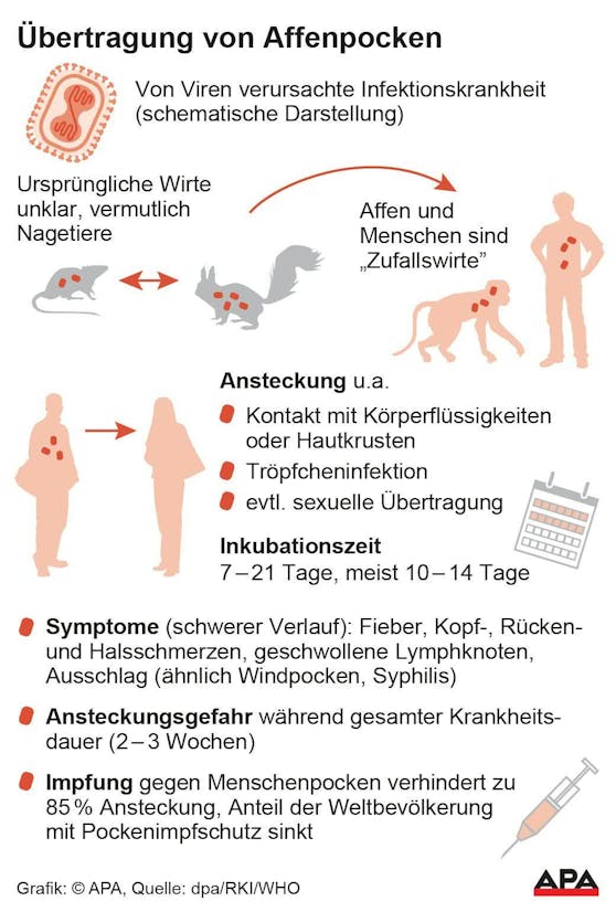 Affenpockenvirus: So werden sie übertragen und das sind ihre Symptome.&nbsp;