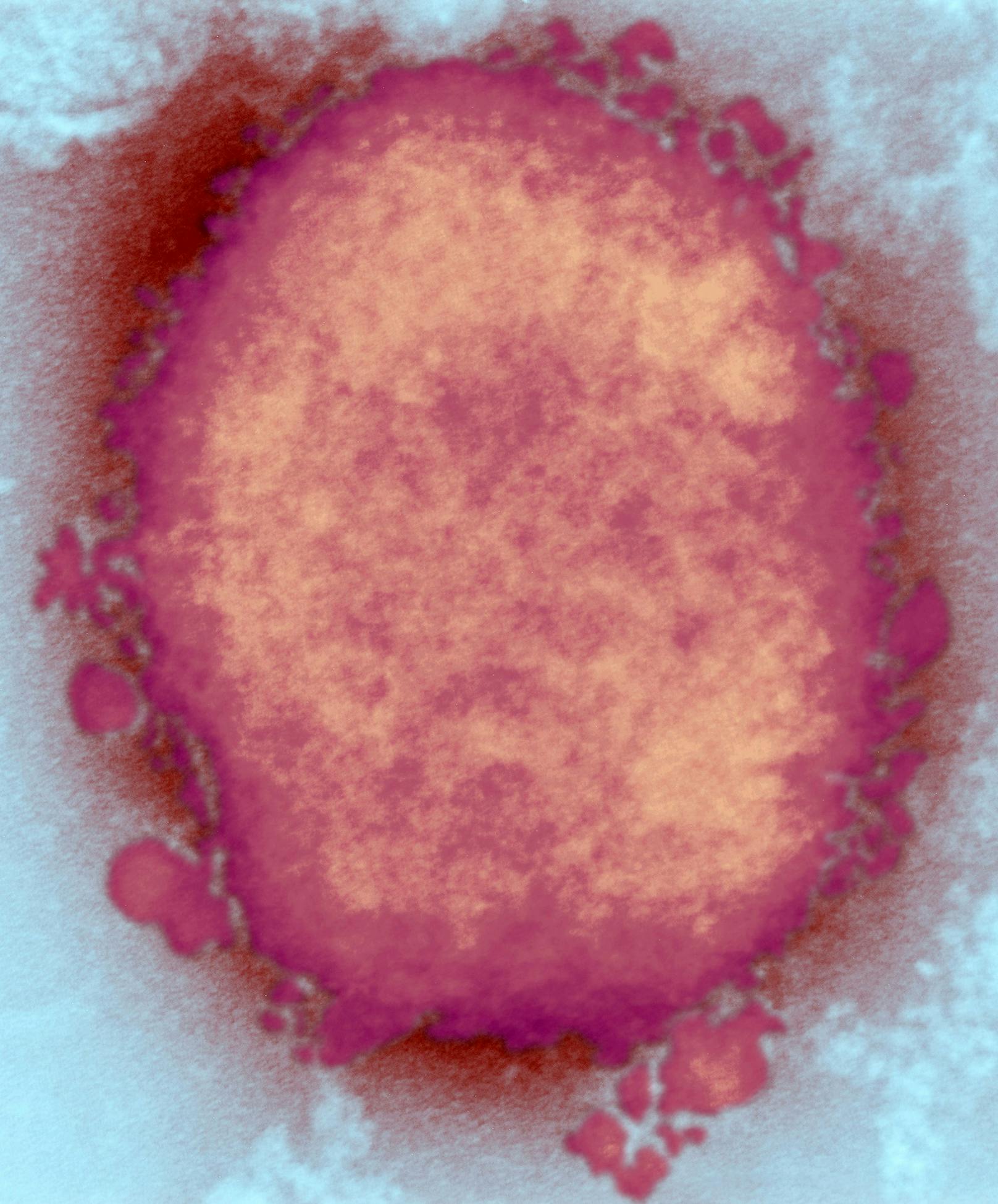 Affenpocken sind ein Pockenvirus, das 1958 bei Cynomolgus-Affen und 1970 beim Menschen nachgewiesen wurde. Das Virus besteht aus einem DNA-Kern in einer Proteinhülle, das von einer Hülle umgeben ist. Affenpocken sind zoonotisch, d.h. sie werden von Tieren (z. B. Nagetieren) auf den Menschen übertragen und umgekehrt. Infektionen beim Menschen werden häufig durch Tierbisse oder durch direkten Kontakt mit infizierten Körperflüssigkeiten verursacht. (im Bild: Partikel des Affenpockenvirus)