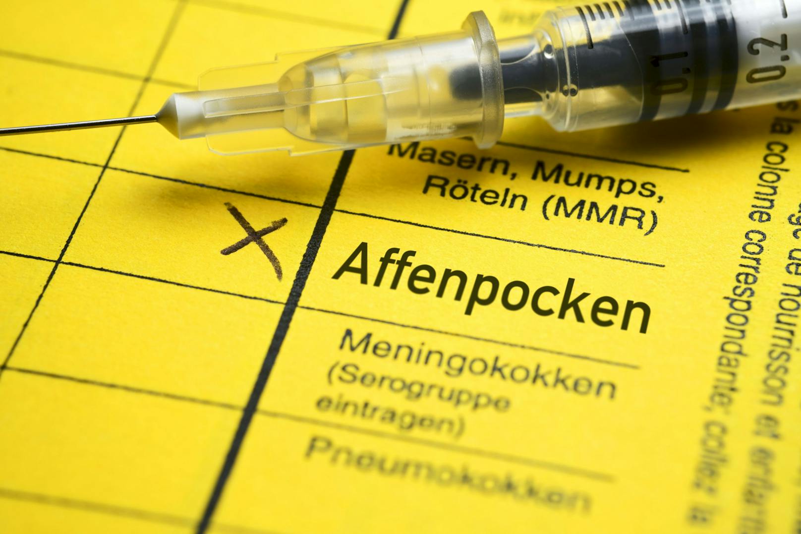 Eine Pocken-Impfpflicht gab es in Österreich bis 1981. 