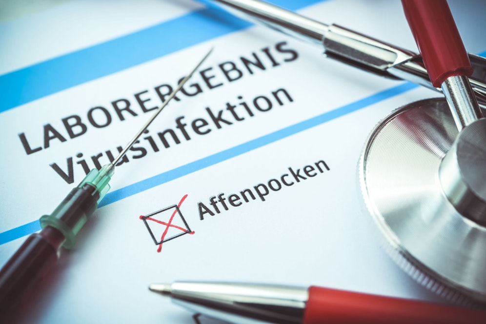 Die Affenpocken sorgen derzeit weltweit für Aufregung.