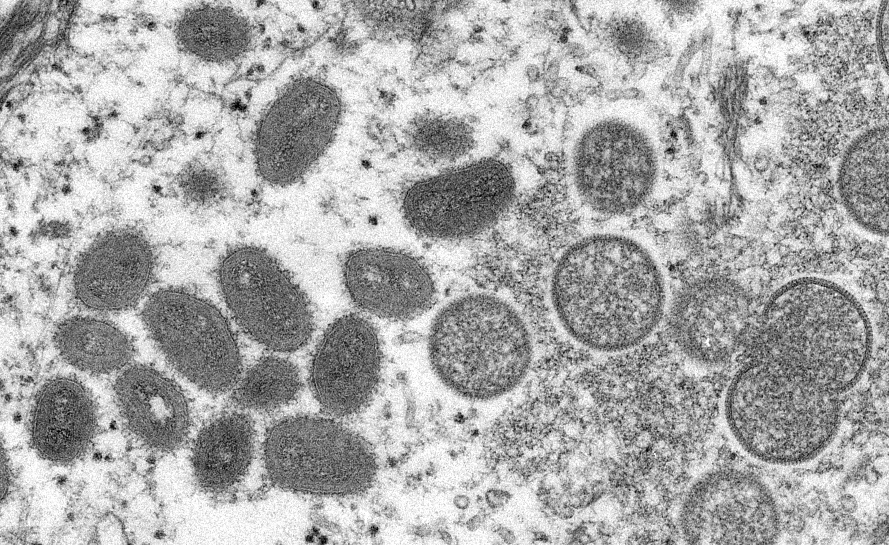An electron microscopic (EM) image shows mature, oval-shaped monkeypox virus particles as well as crescents and spherical particles of immature virions, obtained from a clinical human skin sample associated with the 2003 prairie dog outbreak in this undated image obtained by Reuters on May 18, 2022. Cynthia S. Goldsmith, Russell Regnery/CDC/Handout via REUTERS THIS IMAGE HAS BEEN SUPPLIED BY A THIRD PARTY.