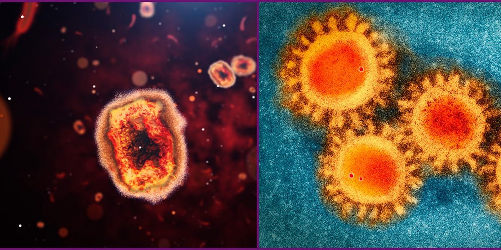 links: Das Affenpockenvirus, rechts: Das Coronavirus.