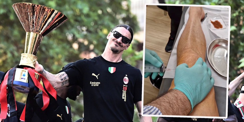 Zlatan Ibrahimovic zeigt in einem Video sein ramponiertes Knie.