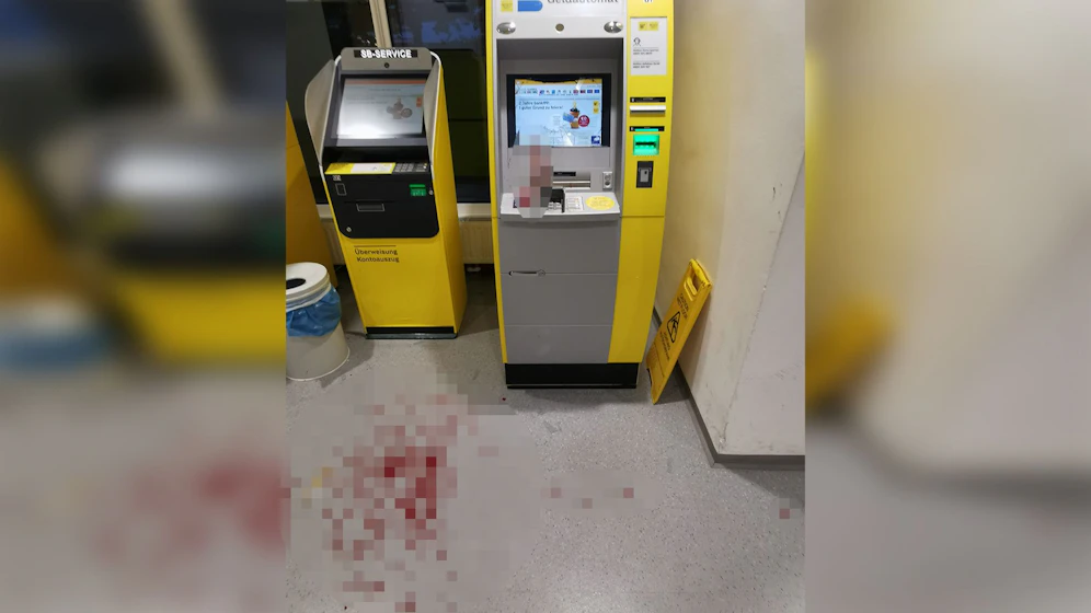 Ein Floridsdorfer schlug am Dienstagabend mit der Faust gegen den Bankomaten und verletzte sich.