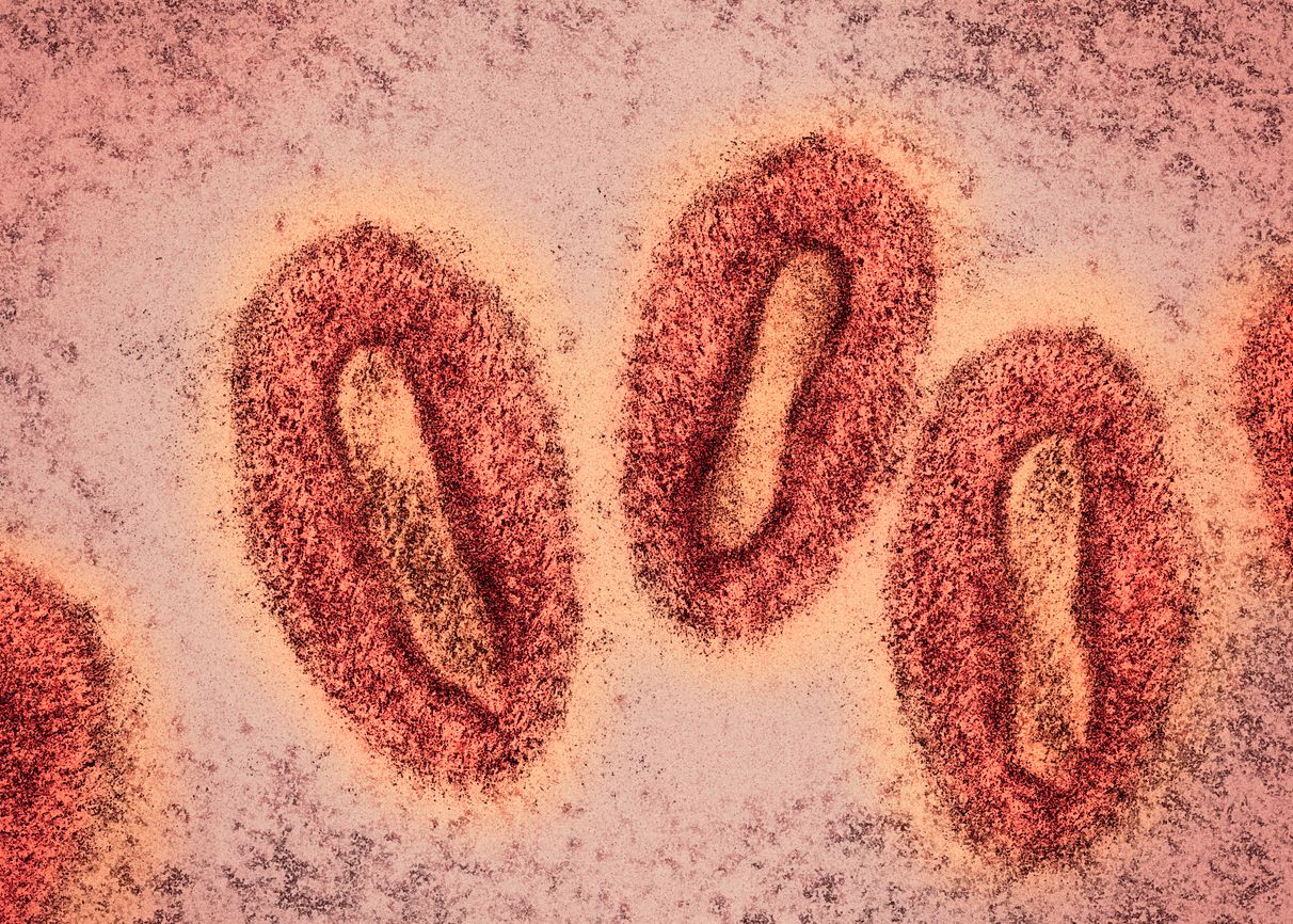 Colored visualisation of monkeypox virus electron microscopy photo