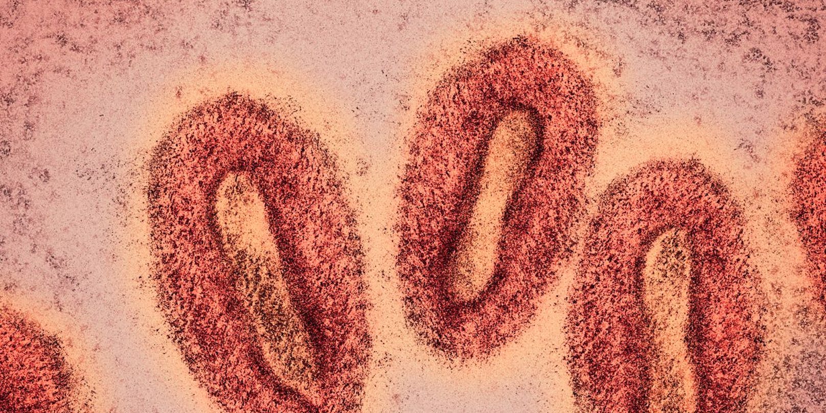 Colored visualisation of monkeypox virus electron microscopy photo