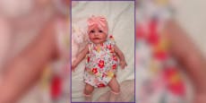 Seltene Krankheit – Baby Ayla hat ein Dauerlächeln