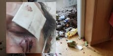 900-€-Müllwohnung, Prügel: "Mein Vermieter ist die Hölle"