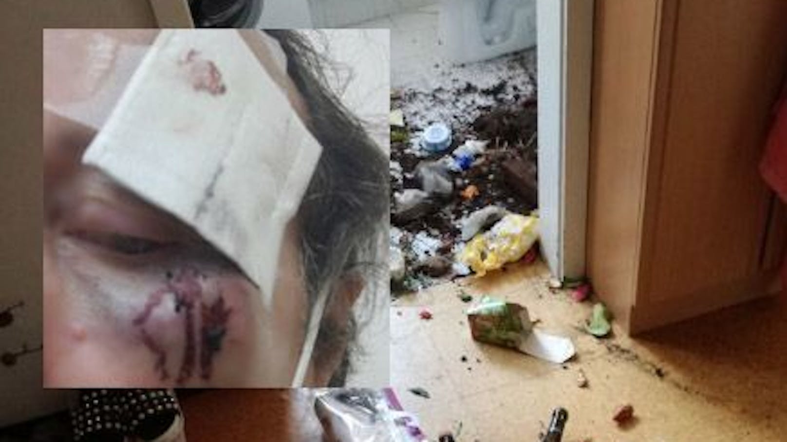 Ekel-Attacke: Müll einfach übers Badfenster in Wohnung geworfen; Mann (57) mit Kopfverletzung