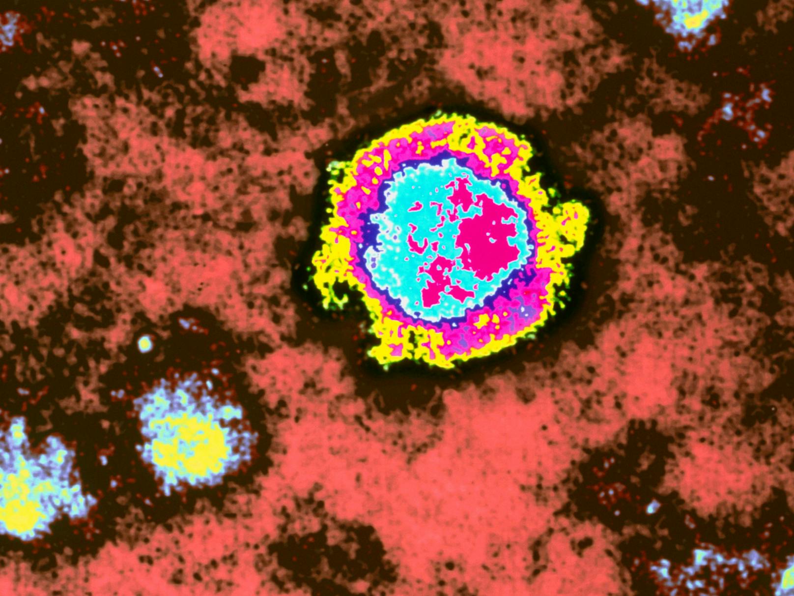 Eingefärbte Aufnahme eines Borna-Virus unter dem Elektronenmikroskop. Archivbild, 1997.