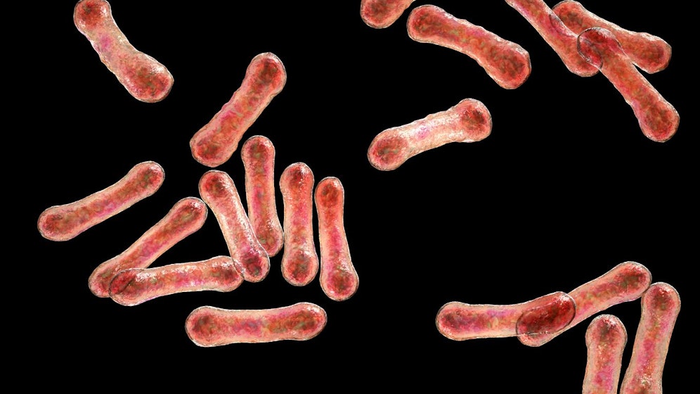 Diptherie wird durch ein bestimmtes toxinbildendes Bakterium – Corynebacterium diphtheriae (Bild) – verursacht.