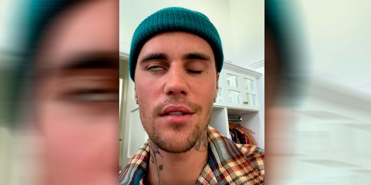 Heute.at - Justin Bieber zeigt sein gelähmtes Gesicht