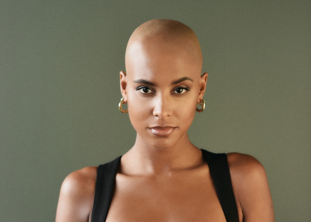 Die Bachelorette leidet unter kreisrundem Haarausfall.&nbsp;