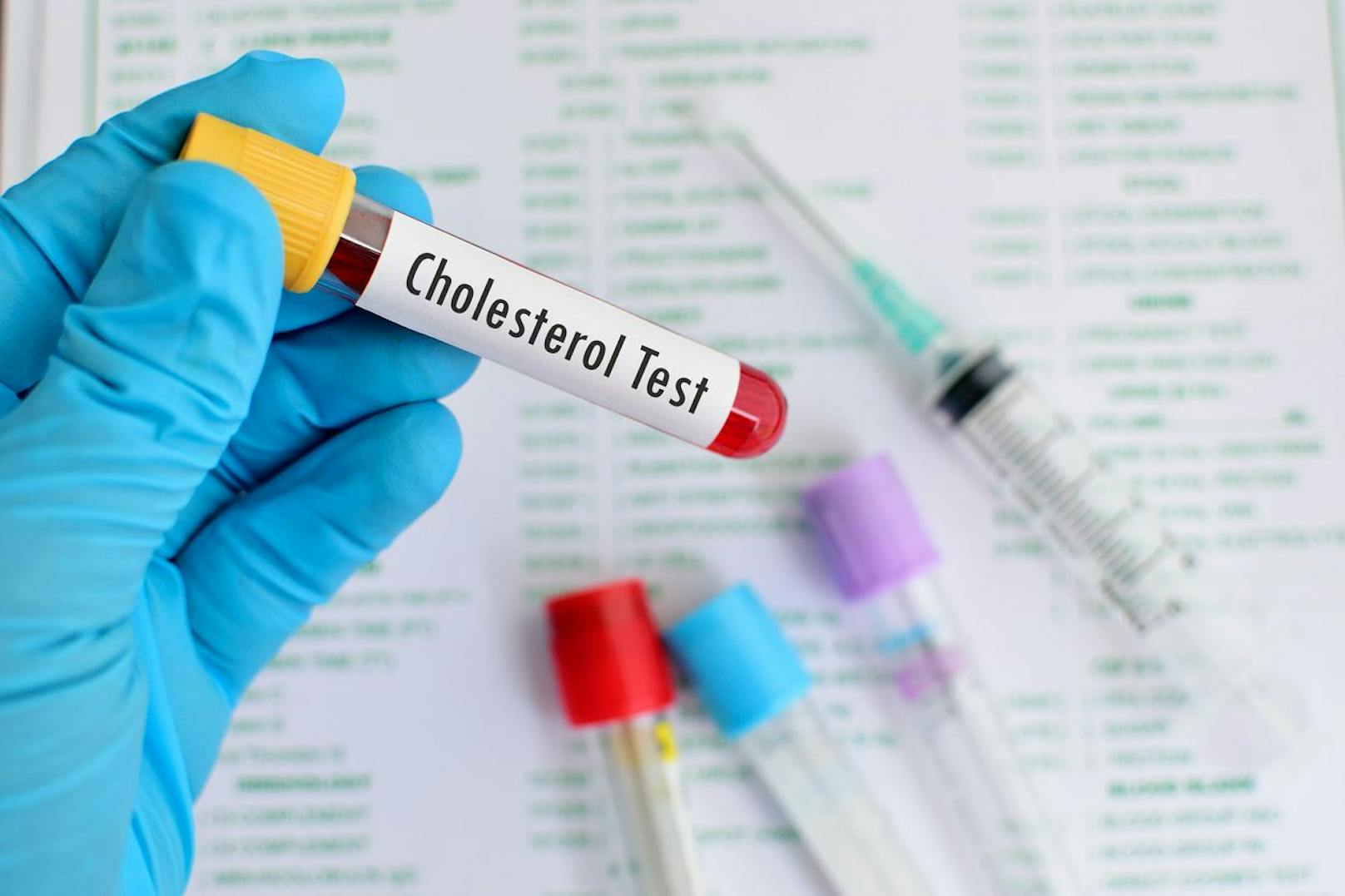 Eine simple Blutuntersuchung zeigt den Cholesterinwert und lässt gegebenenfalls gegensteuern, um ernsthafte Folgen zu verhindern.